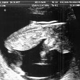 2009 10 - Diddy Jnr Scans